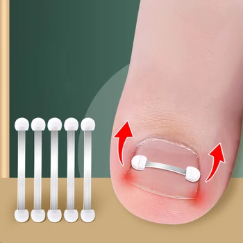 Инструменты для корректора вросшего ногтя на пальце ноги Педикюр Восстановление Embed Лечение ногтей на ногах Профессиональный инструмент для коррекции вросшего ногтя
