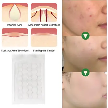 Invisible Acne Treatment Pimple Originality Concealer Patch Tool Beauty Star Красочный Прыщ Пятно Прыщи Уход За Прыщами Макияж Лыжи T8C4